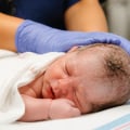 Cephalohematoma After Vacuum-Assisted Delivery: Why Newborn Head Bleeding Occurs, Warning Signs, and Possible Birth Injuries